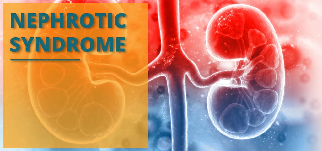 nephrotic-syndrome-control-medicines-in-ayurveda